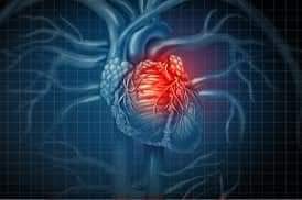 التهاب عضلة القلب